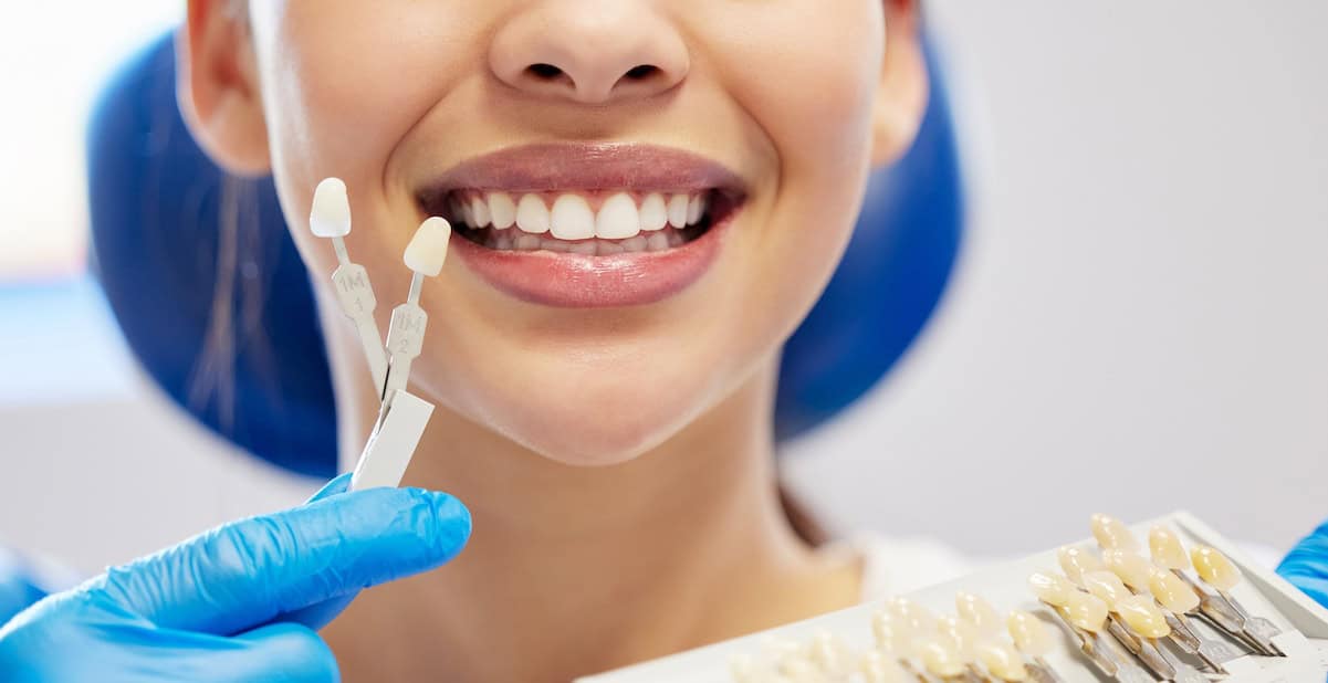 composite vs porcelain veneers